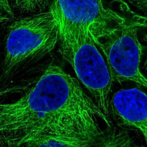 Anti-SLC29A4 antibody produced in rabbit 