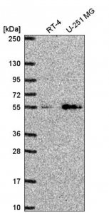 Anti-SLC29A4 antibody produced in rabbit 
