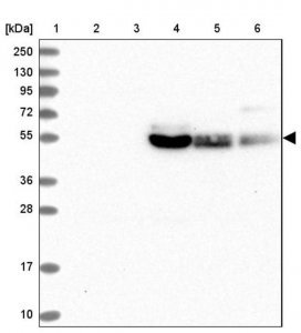 Anti-SLC2A10 antibody produced in rabbit 