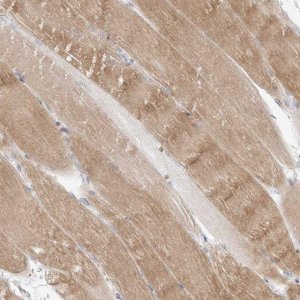 Anti-SLC2A12 antibody produced in rabbit 