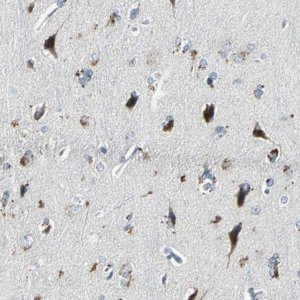 Anti-SLC2A13 antibody produced in rabbit 