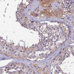Anti-SLC39A13 antibody produced in rabbit 