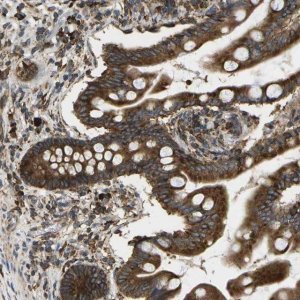 Anti-SLC39A14 antibody produced in rabbit 