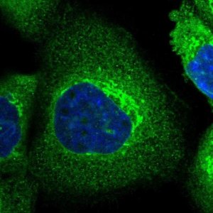 Anti-SLC39A14 antibody produced in rabbit 