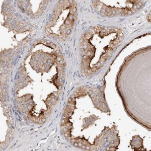 Anti-SLC39A2 antibody produced in rabbit 