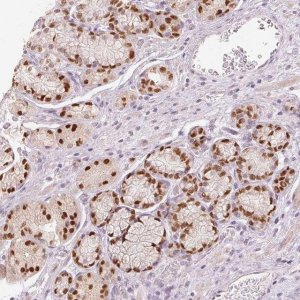 Anti-SLC39A3 antibody produced in rabbit 
