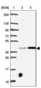 Anti-SLC39A3 antibody produced in rabbit 