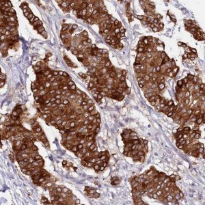 Anti-SLC39A6 antibody produced in rabbit 