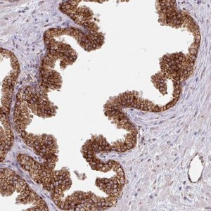 Anti-SLC39A7 antibody produced in rabbit 