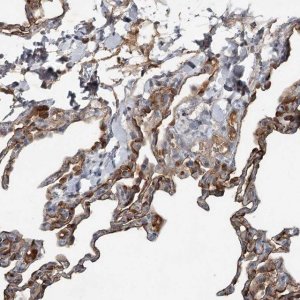 Anti-SLC39A8 antibody produced in rabbit 