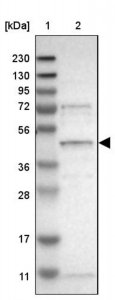Anti-SLC41A1 antibody produced in rabbit 