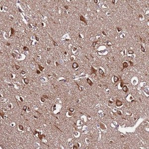 Anti-SLC41A3 antibody produced in rabbit 