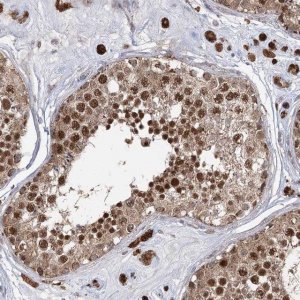 Anti-SLC4A1AP antibody produced in rabbit 