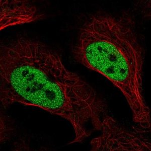 Anti-SLC4A3 antibody produced in rabbit 