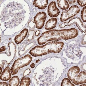 Anti-SLC4A4 antibody produced in rabbit 