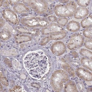 Anti-SLC4A5 antibody produced in rabbit 