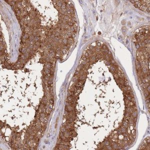 Anti-SLC4A9 antibody produced in rabbit 