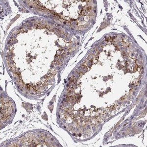 Anti-SLC52A3 antibody produced in rabbit 