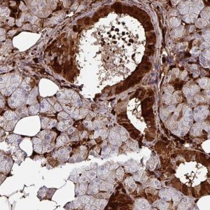 Anti-SLC5A10 antibody produced in rabbit 