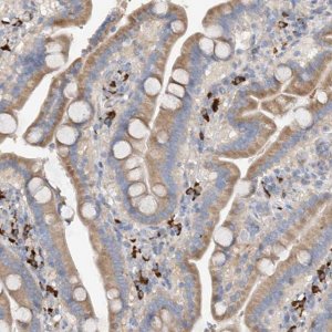 Anti-SLC5A11 antibody produced in rabbit 