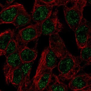 Anti-SLC5A11 antibody produced in rabbit 