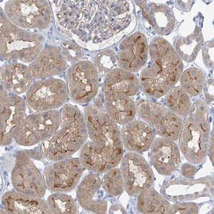 Anti-SLC6A12 antibody produced in rabbit 