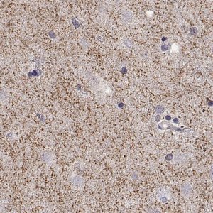 Anti-SLC6A3 antibody produced in rabbit 