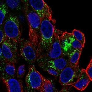 Anti-SLC6A4 antibody produced in rabbit 