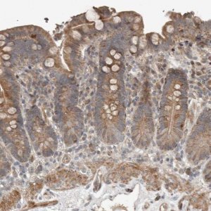 Anti-SLC6A7 antibody produced in rabbit 