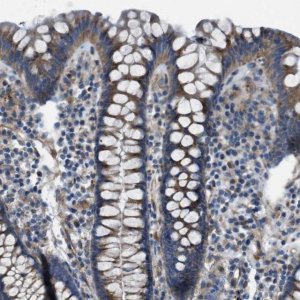 Anti-SLC6A9 antibody produced in rabbit 