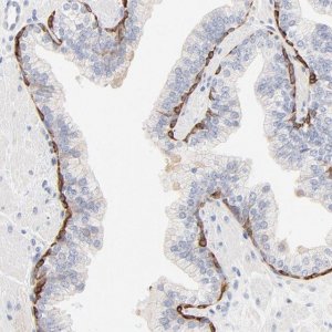 Anti-SLC7A3 antibody produced in rabbit 