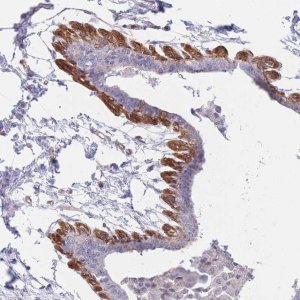 Anti-SLC7A6 antibody produced in rabbit 