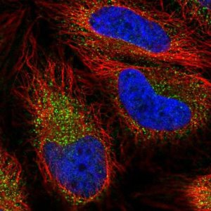 Anti-SLC7A6 antibody produced in rabbit 