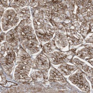 Anti-SLC9A2 antibody produced in rabbit 