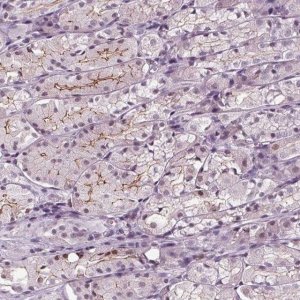Anti-SLC9A4 antibody produced in rabbit 