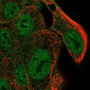 Anti-SLC9A4 antibody produced in rabbit 
