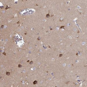 Anti-SLC9A6 antibody produced in rabbit 