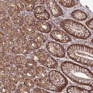 Anti-SLC9B2 antibody produced in rabbit 