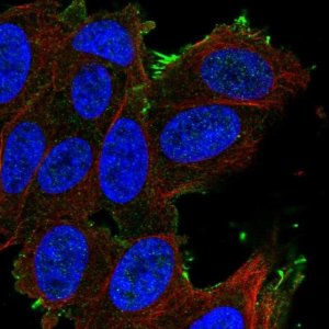 Anti-SLCO1A2 antibody produced in rabbit 