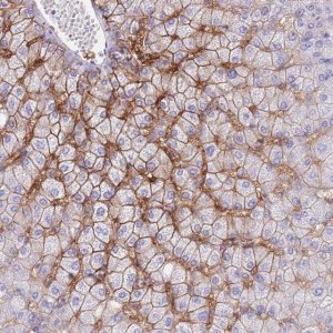 Anti-SLCO1B3 antibody produced in rabbit 