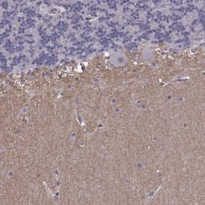 Anti-SLCO3A1 antibody produced in rabbit 