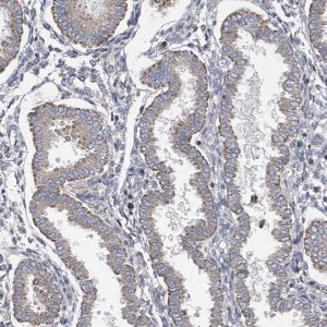 Anti-SLCO4A1 antibody produced in rabbit 