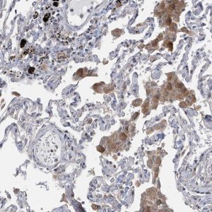 Anti-SLCO4A1 antibody produced in rabbit 