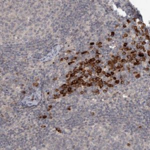 Anti-SLCO5A1 antibody produced in rabbit 