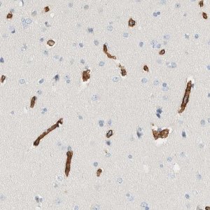 Anti-SLFN12 antibody produced in rabbit 