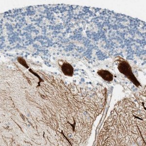 Anti-SLFN12 antibody produced in rabbit 