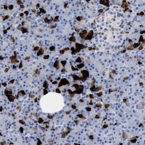 Anti-SLFN13 antibody produced in rabbit 