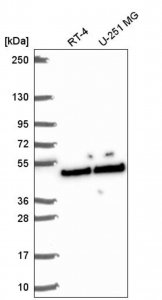 Anti-SLFNL1 antibody produced in rabbit 