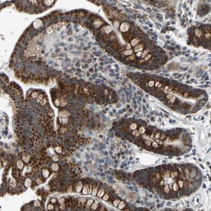 Anti-SLIRP antibody produced in rabbit HPA020291-100UL