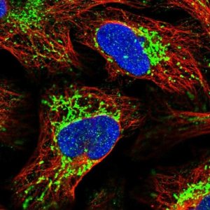 Anti-SLIRP antibody produced in rabbit HPA020291-100UL